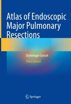 Atlas of Endoscopic Major Pulmonary Resections de Dominique Gossot