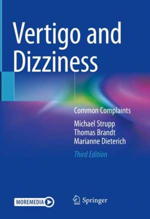 Vertigo and Dizziness: Common Complaints de Michael Strupp