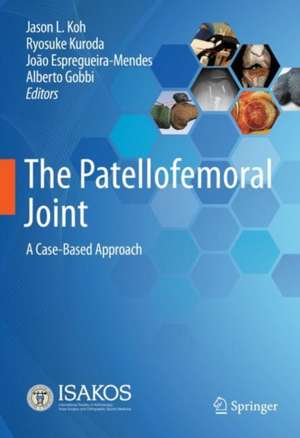 The Patellofemoral Joint: A Case-Based Approach de Jason L. Koh