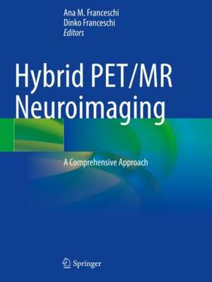 Hybrid PET/MR Neuroimaging: A Comprehensive Approach de Ana M. Franceschi