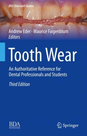 Tooth Wear: An Authoritative Reference for Dental Professionals and Students de Andrew Eder