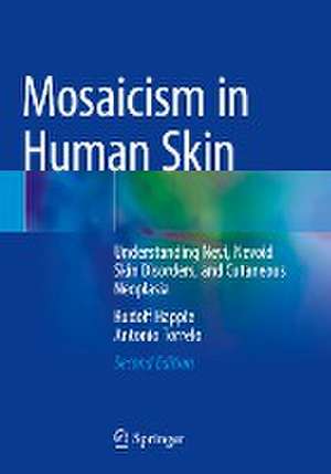 Mosaicism in Human Skin: Understanding Nevi, Nevoid Skin Disorders, and Cutaneous Neoplasia de Rudolf Happle