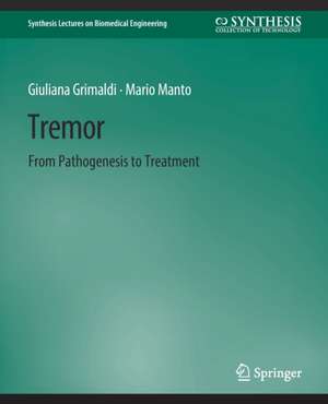 Tremor: From Pathogenesis to Treatment de Giulana Grimaldi