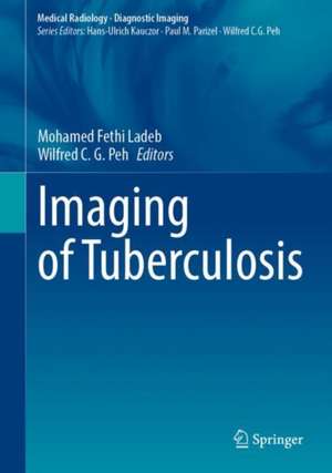 Imaging of Tuberculosis de Mohamed Fethi Ladeb