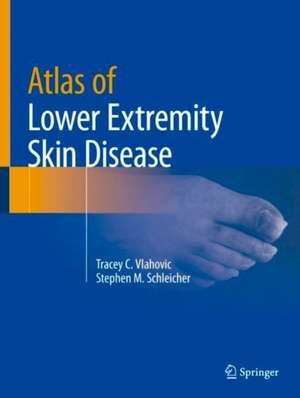 Atlas of Lower Extremity Skin Disease de Tracey C. Vlahovic