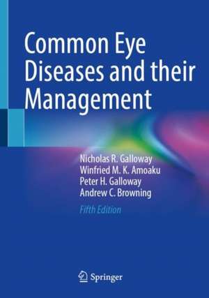 Common Eye Diseases and their Management de Nicholas R. Galloway