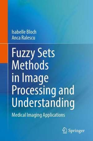 Fuzzy Sets Methods in Image Processing and Understanding: Medical Imaging Applications de Isabelle Bloch