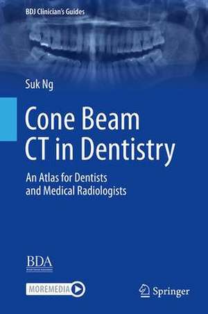 Cone Beam CT in Dentistry: An Atlas for Dentists and Medical Radiologists de Suk Y. Ng