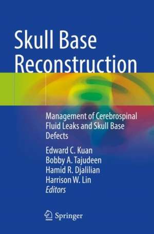 Skull Base Reconstruction: Management of Cerebrospinal Fluid Leaks and Skull Base Defects de Edward C. Kuan