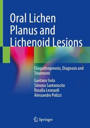 Oral Lichen Planus and Lichenoid Lesions: Etiopathogenesis, Diagnosis and Treatment de Gaetano Isola