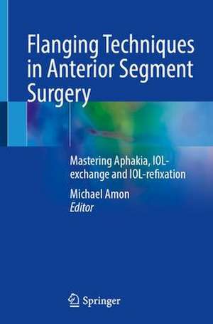 Flanging Techniques in Anterior Segment Surgery: Mastering Aphakia, IOL-exchange and IOL-refixation de Michael Amon