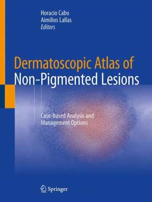 Dermatoscopic Atlas of Non-Pigmented Lesions: Case-based Analysis and Management Options de Horacio Cabo