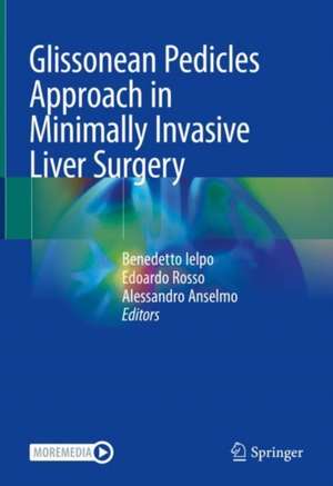 Glissonean Pedicles Approach in Minimally Invasive Liver Surgery de Benedetto Ielpo