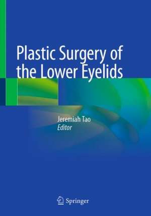 Plastic Surgery of the Lower Eyelids de Jeremiah P. Tao