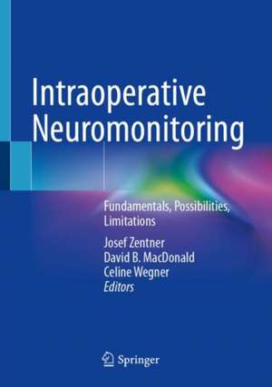 Intraoperative Neuromonitoring: Fundamentals, Possibilities, Limitations de Josef Zentner