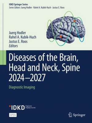 Diseases of the Brain, Head and Neck, Spine 2024-2027: Diagnostic Imaging de Juerg Hodler