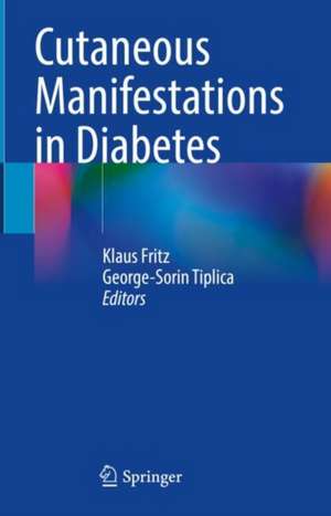 Cutaneous Manifestations in Diabetes de Klaus Fritz