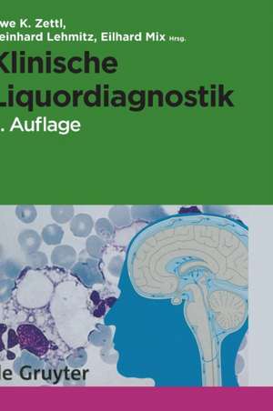 Klinische Liquordiagnostik de Uwe K. Zettl