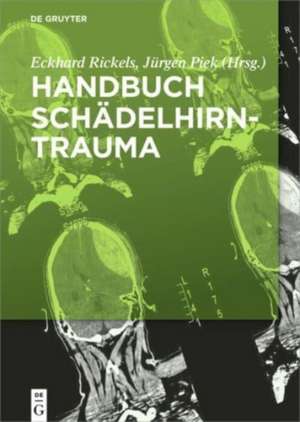 Handbuch Schaedelhirntrauma