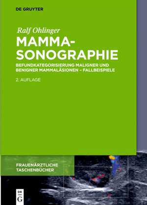 Mammasonographie: Beispiele maligner und benigner Befunde – adaptiert an die aktuelle BIRADS® Klassifikation 2013 de Ralf Ohlinger