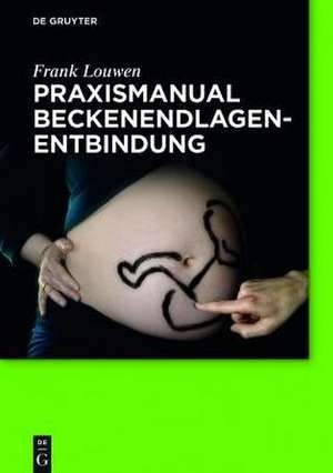 Praxismanual Beckenendlagenentbindung de Frank Louwen