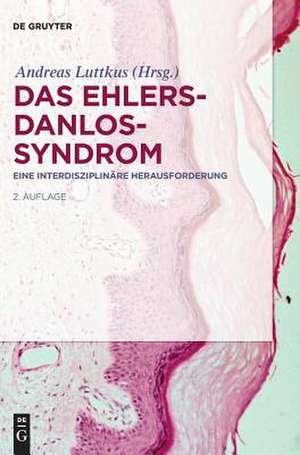 Das Ehlers-Danlos-Syndrom: Eine interdisziplinäre Herausforderung de Andreas Luttkus