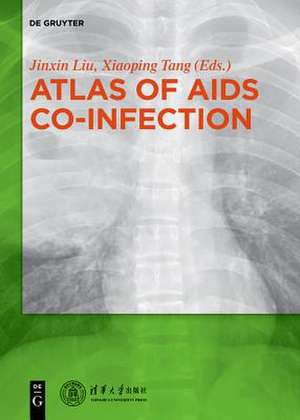 Atlas of AIDS Co-infection de Tang Xiaoping