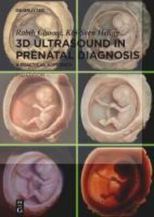 3D Ultrasound in Prenatal Diagnosis de Rabih Chaoui