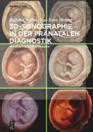 3D-Sonographie in der pränatalen Diagnostik de Rabih Chaoui