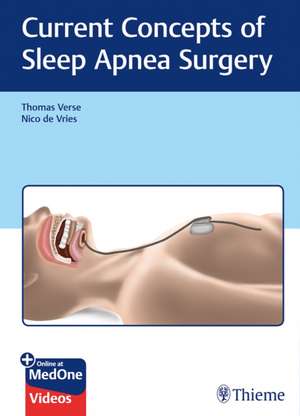 Current Concepts of Sleep Apnea Surgery de Thomas Verse