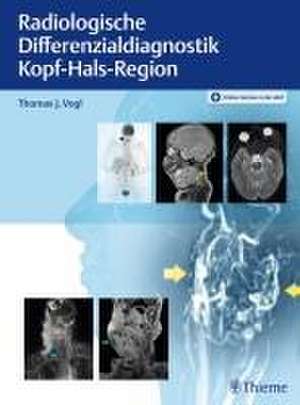 Radiologische Differenzialdiagnostik Kopf-Hals-Region de Thomas J. Vogl