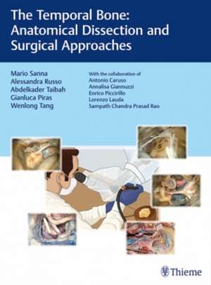 The Temporal Bone – Anatomical Dissection and Surgical Approaches de Mario Sanna