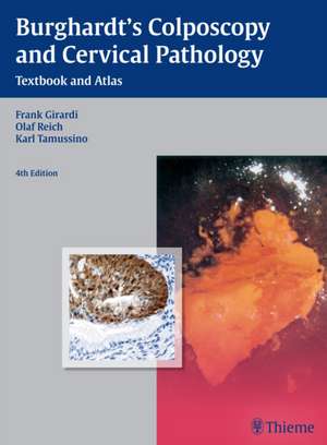 Burghardt`s Colposcopy and Cervical Pathology – Textbook and Atlas de Erich Burghardt