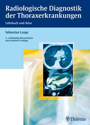 Radiologische Diagnostik der Thoraxerkrankungen de Sebastian Lange