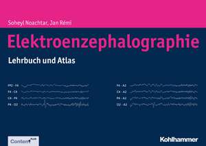 Elektroenzephalographie: Atlas Und Lehrbuch de Soheyl Noachtar