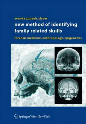 New Method of Identifying Family Related Skulls: Forensic Medicine, Anthropology, Epigenetics de Zvonka Zupanic Slavec