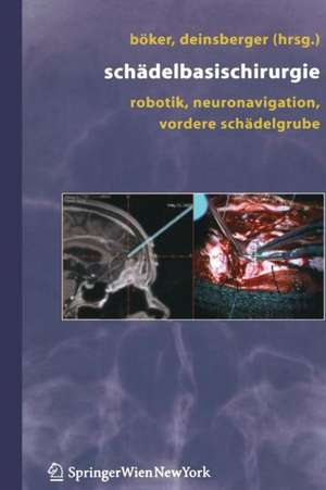 Schädelbasischirurgie: Robotik, Neuronavigation, vordere Schädelgrube de D. -K. Böker