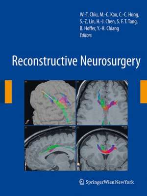 Reconstructive Neurosurgery de Wen-Ta Chiu