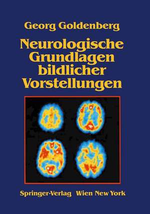 Neurologische Grundlagen bildlicher Vorstellungen de G. Goldenberg