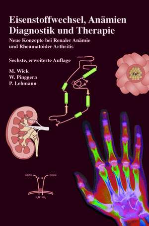 Eisenstoffwechsel, Anämien Therapie und Diagnose: Neue Konzepte bei Renaler Anämie und Rheumatoider Arthritis de M. Wick