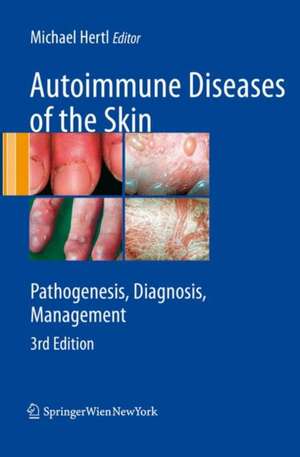 Autoimmune Diseases of the Skin: Pathogenesis, Diagnosis, Management de Michael Hertl