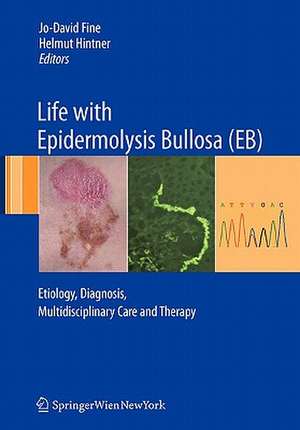 Life with Epidermolysis Bullosa (EB): Etiology, Diagnosis, Multidisciplinary Care and Therapy de Jo-David Fine