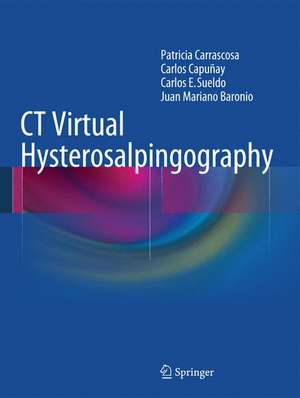 CT Virtual Hysterosalpingography de Patricia Carrascosa