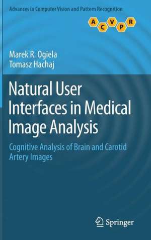 Natural User Interfaces in Medical Image Analysis: Cognitive Analysis of Brain and Carotid Artery Images de Marek R. Ogiela