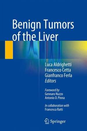 Benign Tumors of the Liver de Luca Aldrighetti