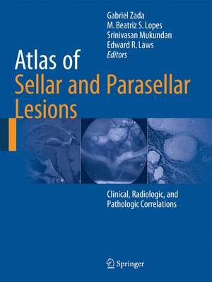 Atlas of Sellar and Parasellar Lesions: Clinical, Radiologic, and Pathologic Correlations de Gabriel Zada