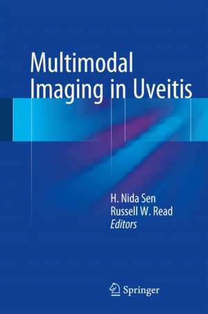 Multimodal Imaging in Uveitis de H. Nida Sen