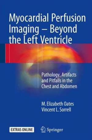 Myocardial Perfusion Imaging - Beyond the Left Ventricle: Pathology, Artifacts and Pitfalls in the Chest and Abdomen de M. Elizabeth Oates