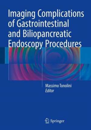 Imaging Complications of Gastrointestinal and Biliopancreatic Endoscopy Procedures de Massimo Tonolini