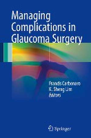 Managing Complications in Glaucoma Surgery de Francis Carbonaro